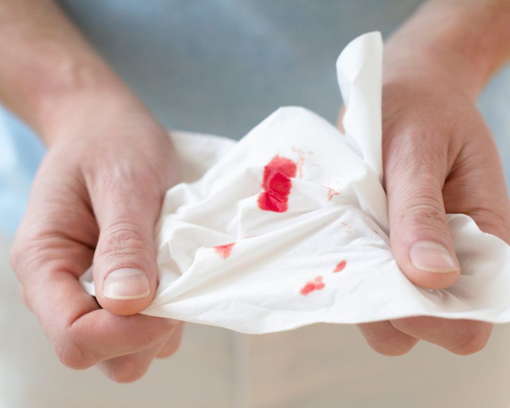 Persona sosteniendo un papel lleno de sangre debido a un sangrado nasal